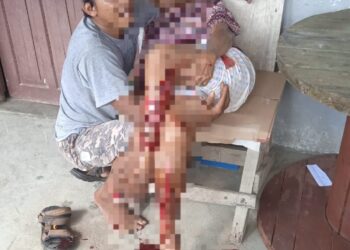 Lakalantas 2 Septor di Simalungun, Opung Tumiar Dilarikan ke Rumah Sakit